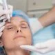 blefaroplastia